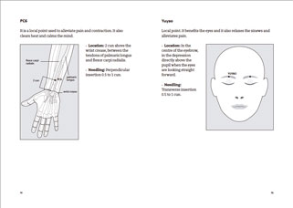 pàgina d'Acupuncture manual